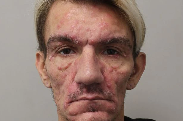 Sick rapist 'only interested in own sexual desires' gave victim HIV as others urged to come forward