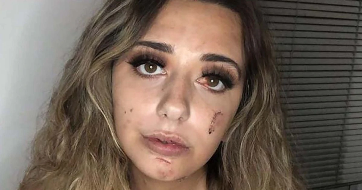 Thug nearly killed woman in pub glass attack leaving her with horror injuries