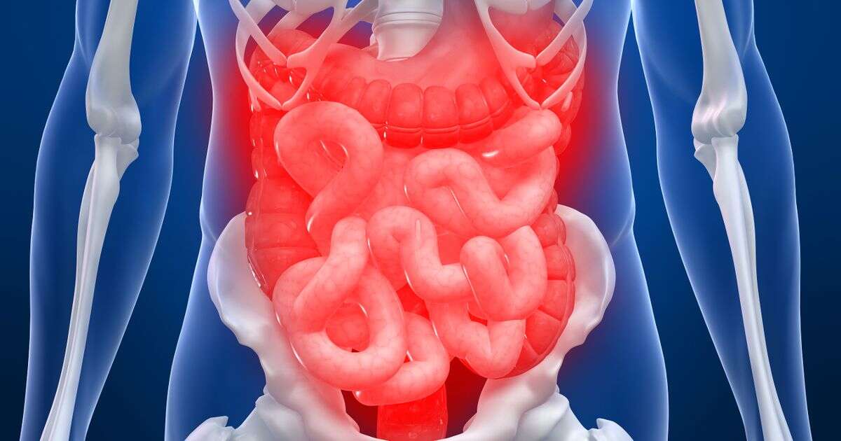 opinionBowel drug breakthrough after 'holy grail' discovery marks step towards Crohn’s-free world