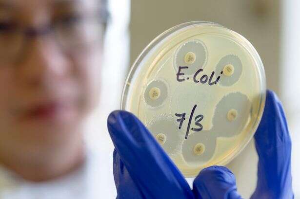 Rise in superbugs blamed on one thing – and there's no getting away from them