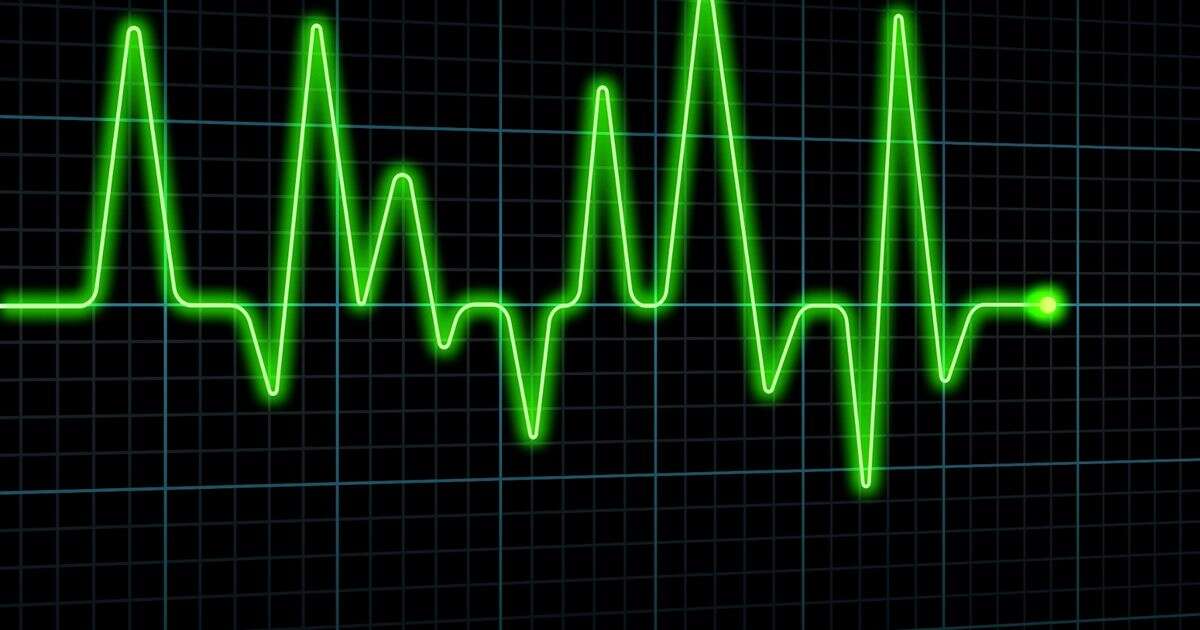 opinion'Artificial Intelligence reading ECGs to predict heart attacks and patient deaths'