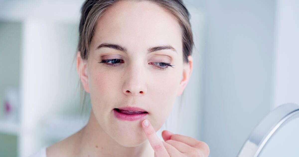 'Strange' symptom on your lips may mean you have 'silent killer' condition