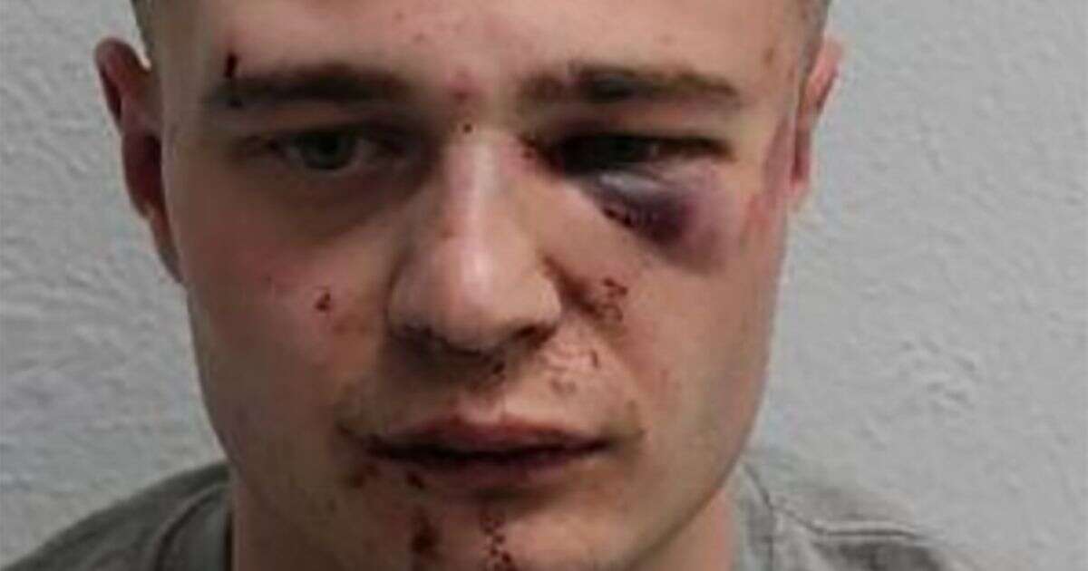 Bloodied mugshot of thug who assaulted three women before hero boys detained him