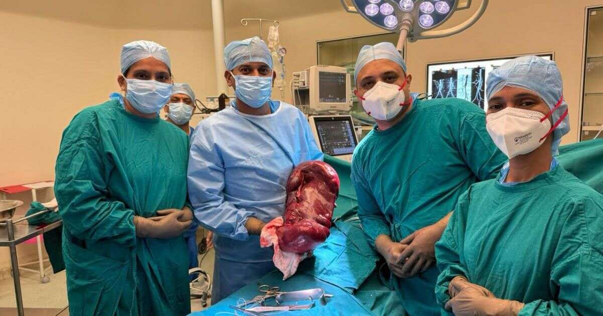 Doctors remove 20lb spleen 'the size of a toddler' from man after 17-year ordeal