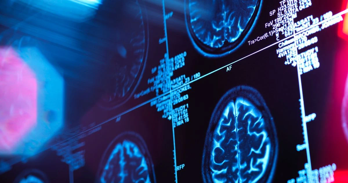 Dementia experts share one habit they would never do in the evening