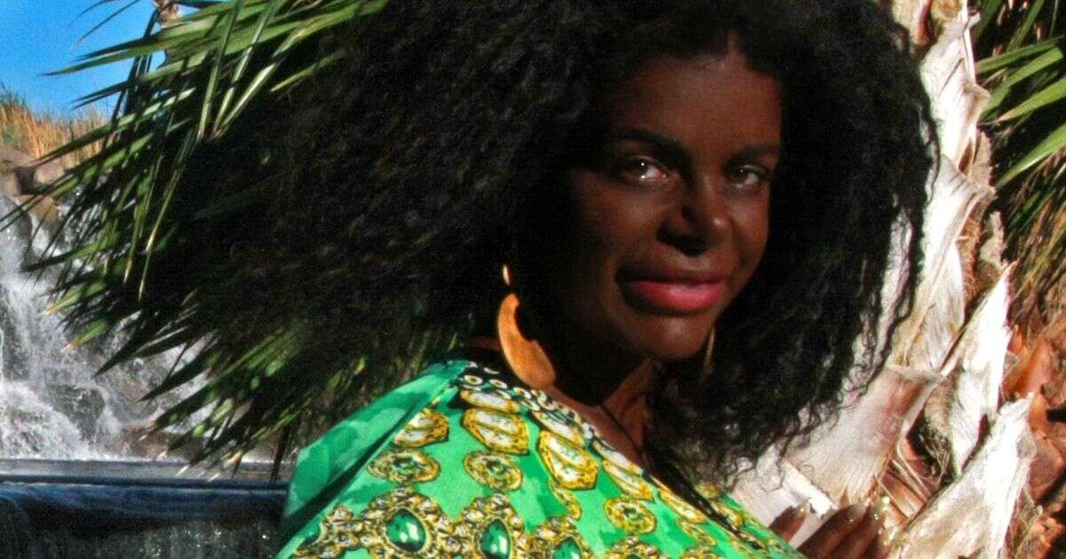 Woman born fair with blond hair says she is 'black' and moving to Africa