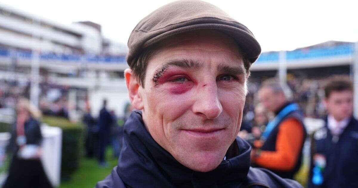 Top Cheltenham Festival jockey reveals surprise truth behind horrendous black eye