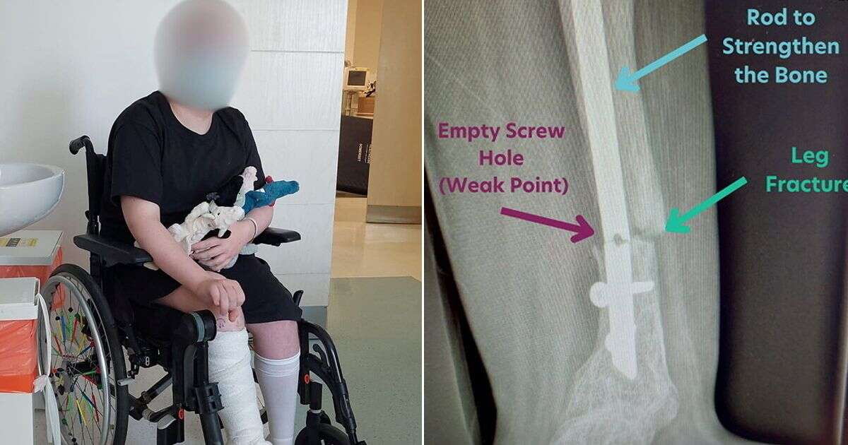 'We trusted our son's friendly surgeon - until he had to have his leg amputated due to his mistake'