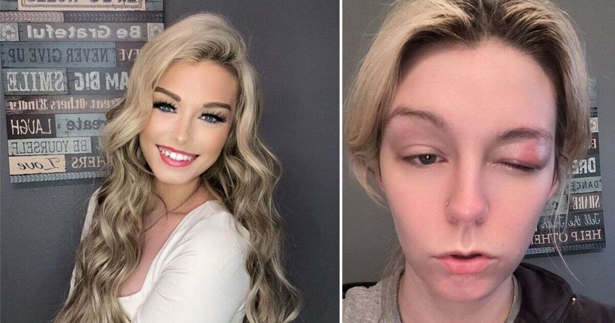 'I'm a TikTok star and stress over the US ban made me go blind for nine days'