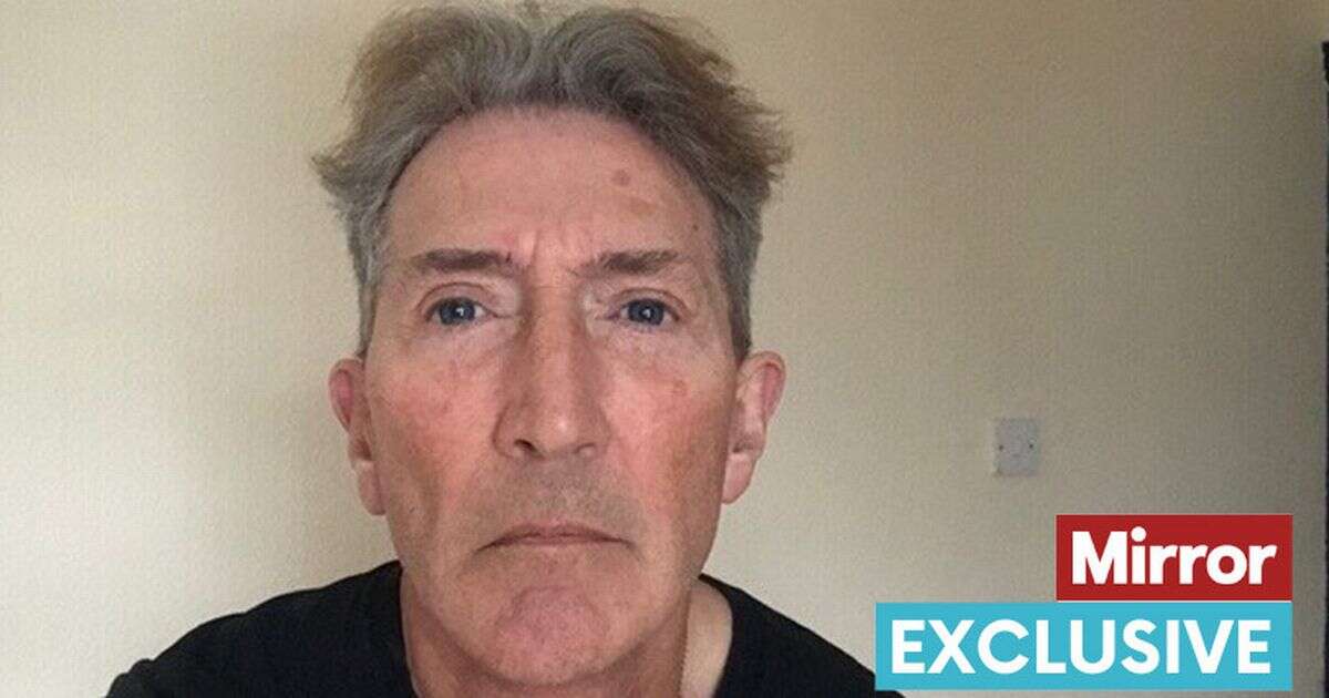 Man, 64, looks '20 years younger' after extreme face lift as he shares wild results