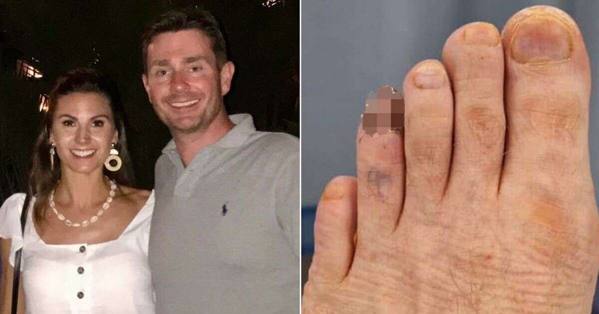 'Wife spotted tiny change in my toenail that doctors dismissed - truth was far scarier'