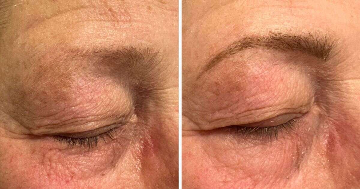 'I lost my brows during chemo but Benefit's new pen made them look natural again'