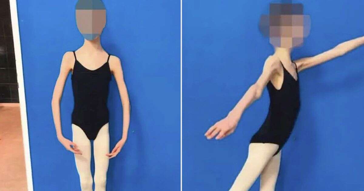 Parents who let ballerina daughter shrink to just 4st sent to prison as daughter speaks out