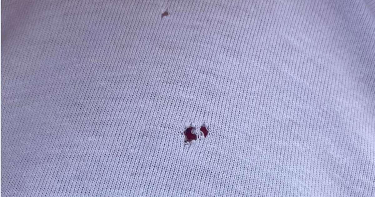 People are only just realising why little holes keep appearing 'around naval' on T-shirts