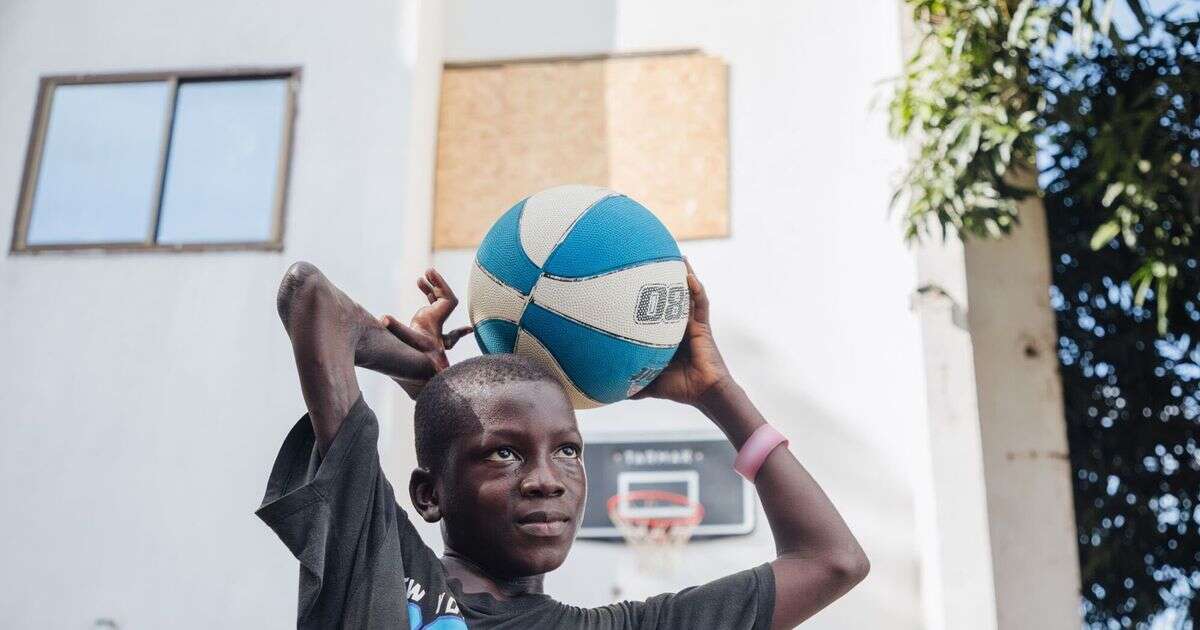 Boy, 5, left with deformed arm after being bitten by a snake as he played football