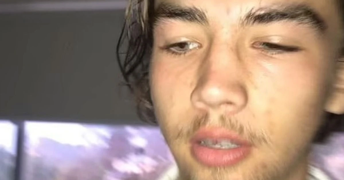 Teen wakes up from coma after being 'head-butted' by whale that leapt onto boat