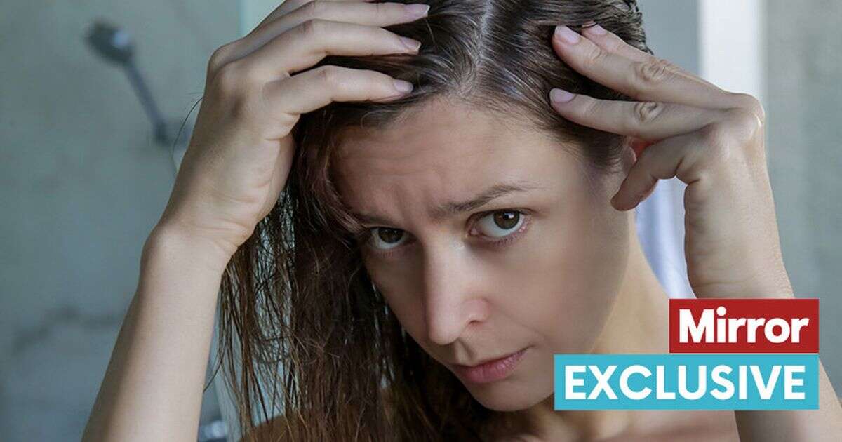 Going grey in your twenties could be a sign of serious underlying health problem