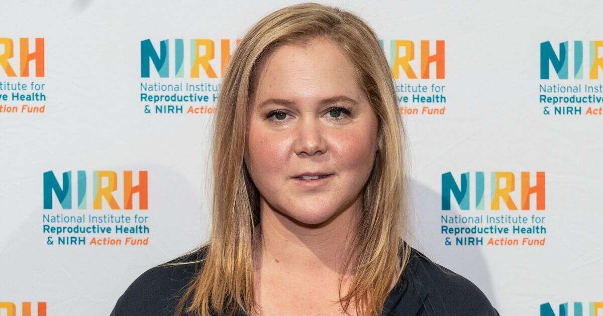 Symptoms of Cushing's Syndrome as Amy Schumer explains 'moon face'