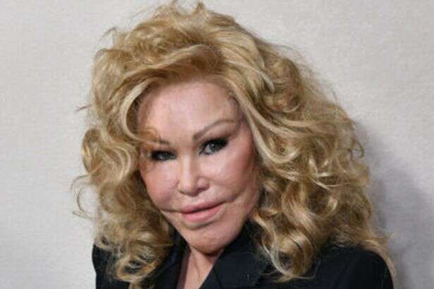 Tragic 'catwoman' Jocelyn Wildenstein's life from huge net worth to Trump Tower row