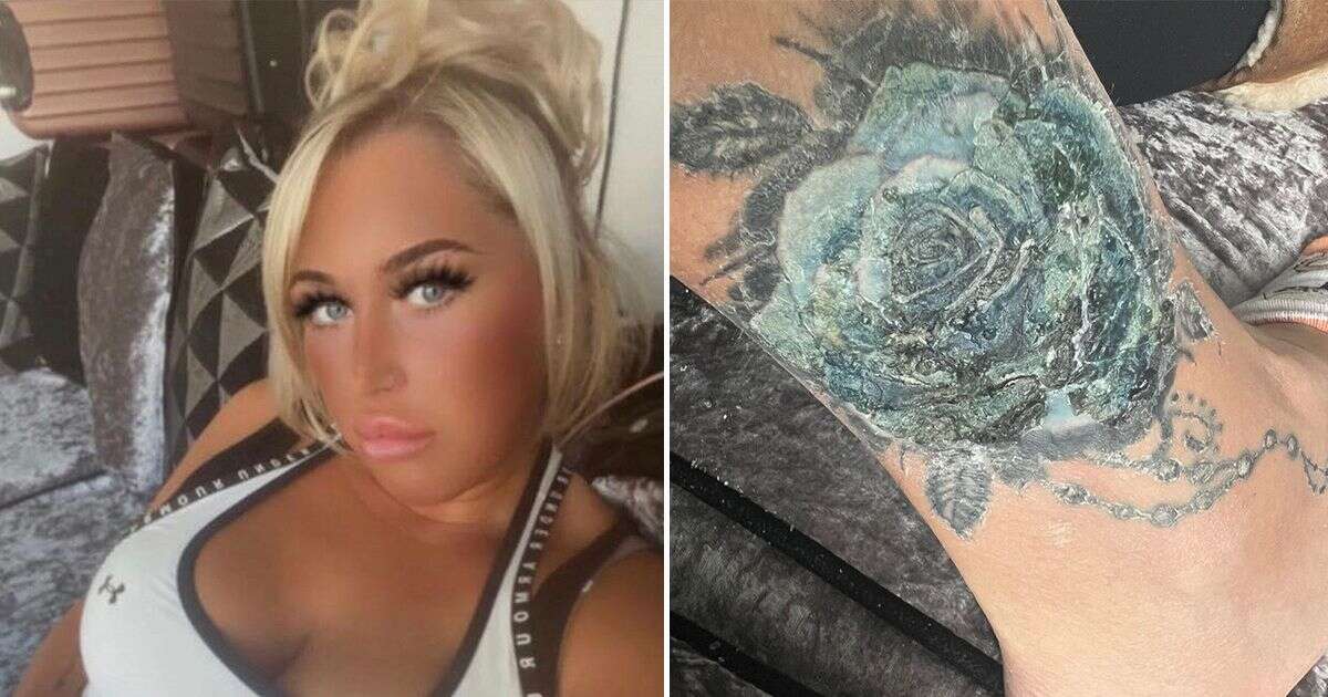 'Turkey holiday tattoo infection left me facing having my foot amputated'