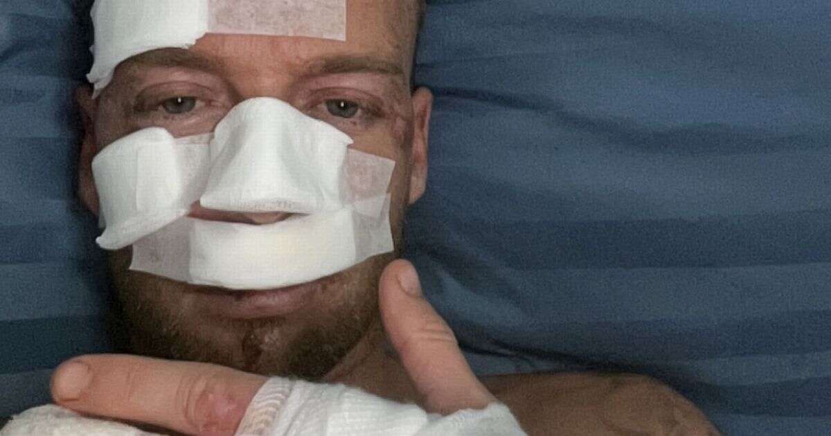 'Horror scooter crash that wasn't my fault left me covered in blood and £1.5k in debt'