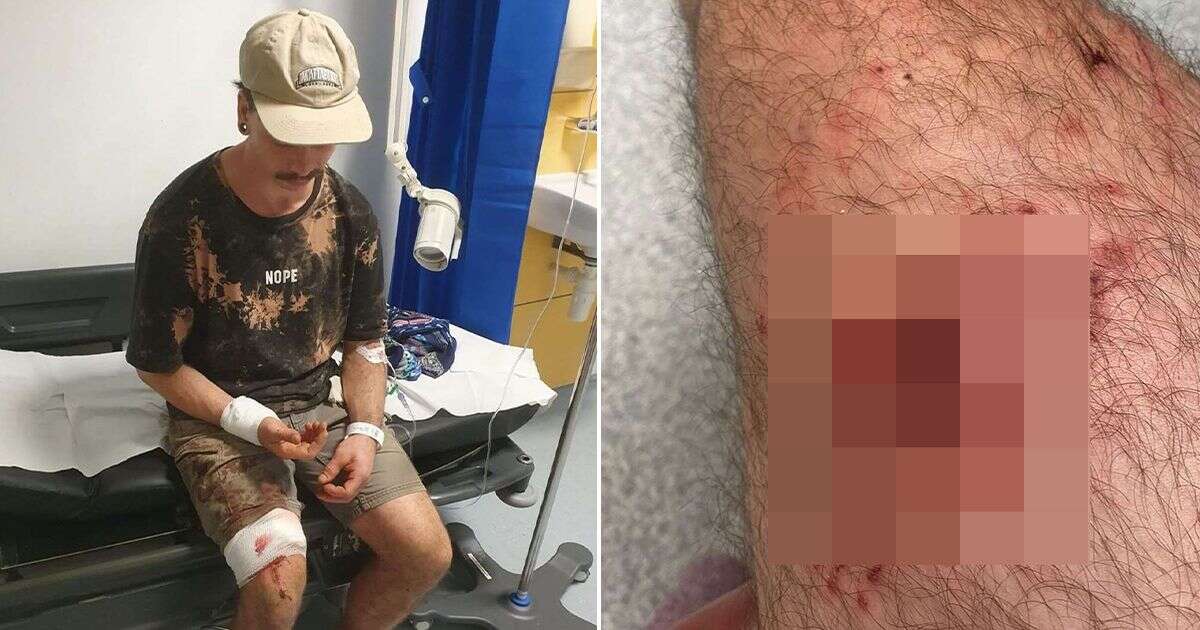 Bike technician 'left for dead' after being attacked by 'Rottweiler' in woods