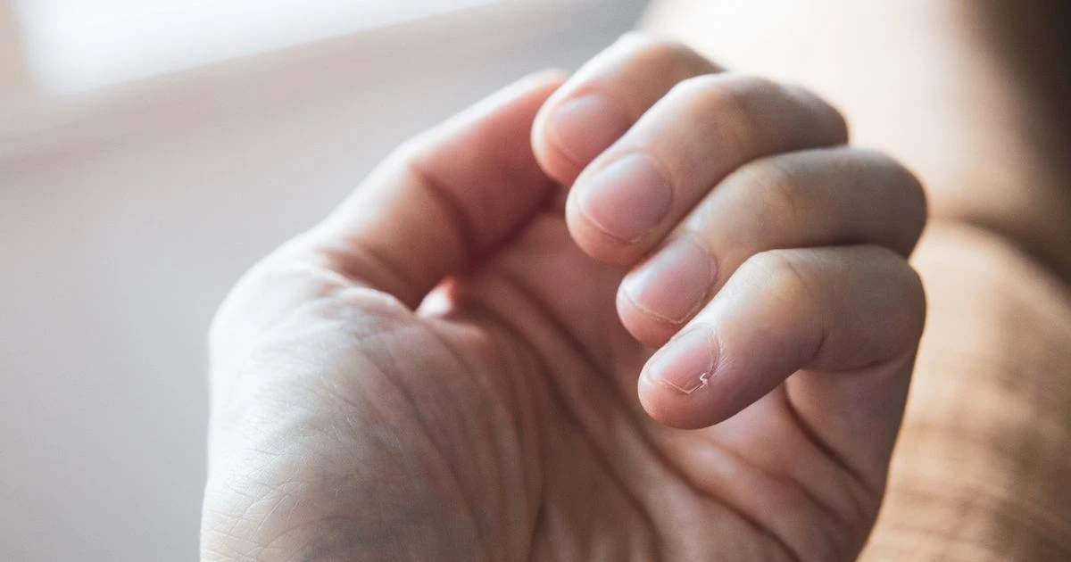 Subtle sign on your nail bed could be symptom of rare skin cancerSkin cancer