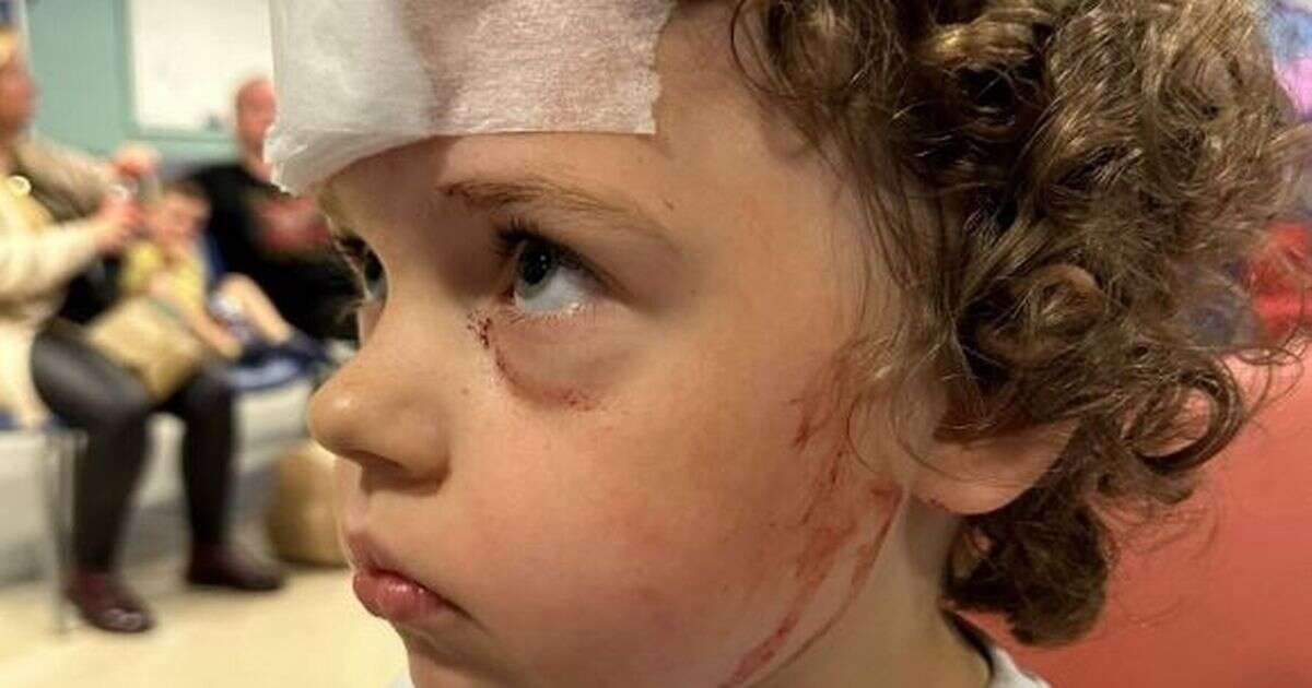 Boy, 4, suffers horror injuries from anti-skateboarding 'blade' in Manchester city centre