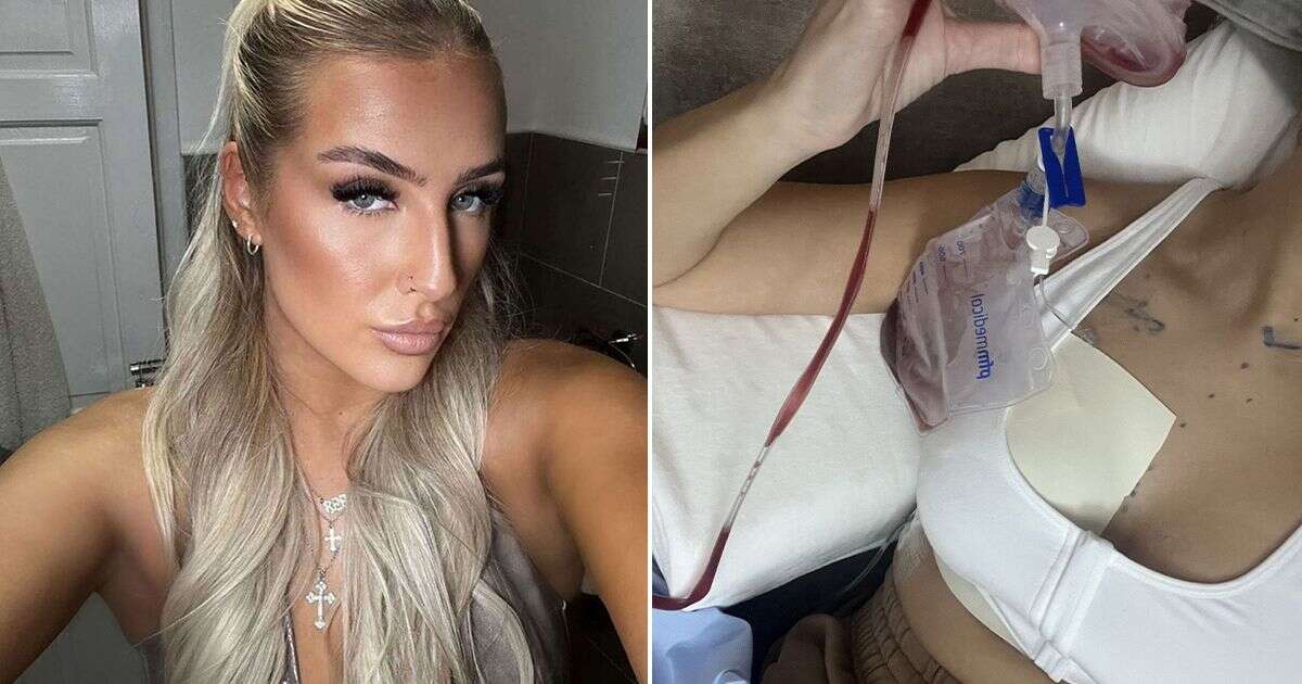 'Doctors kept dismissing my bleeding nipple – now I'm 26-years-old with only one boob'