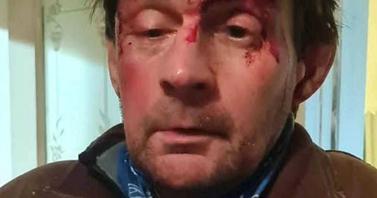 Vulnerable man, 53, thrown into wall and battered yards from his home for just £20