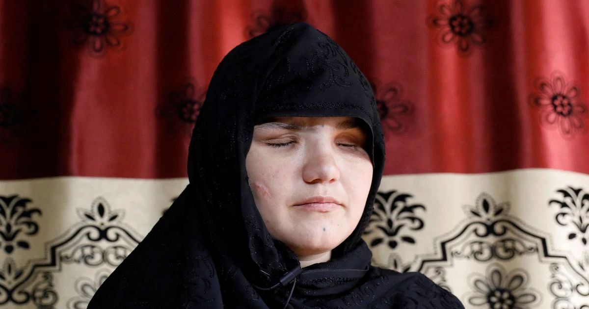 Woman blinded after being shot and stabbed by men on motorbikes 'for getting job'