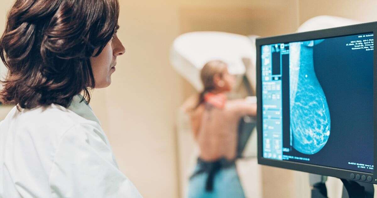 Groundbreaking science could soon predict who will get breast cancer before tumours can form