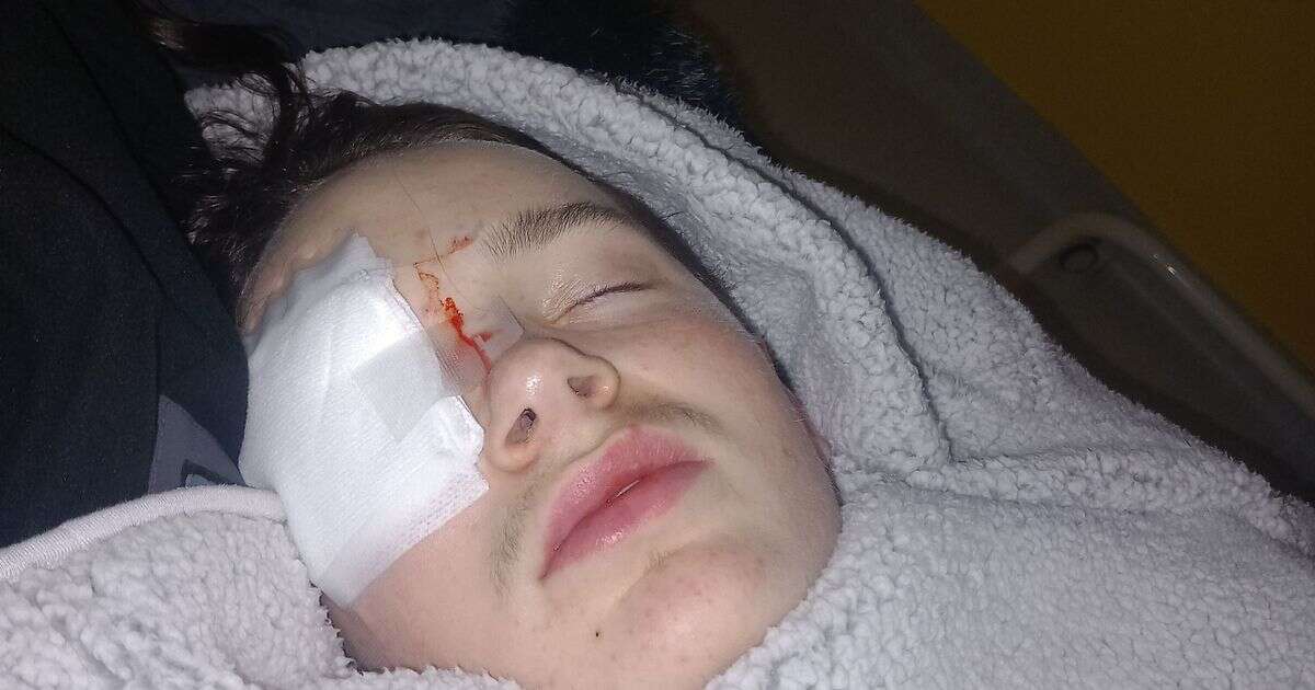 Schoolboy, 14, goes blind after rogue firework hit his eye while walking in the park