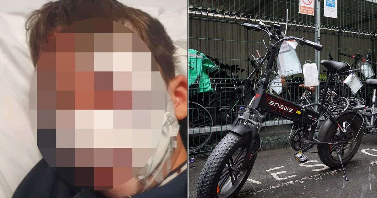 Boy, 10, left with 'nose hanging off' after e-bike crashes into him and driver flees