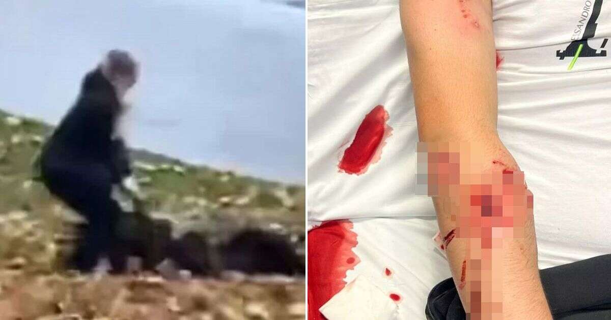 Horror moment schoolboy, 14, mauled by vicious dog in park before owners 'run off'