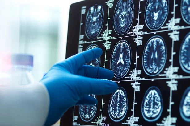 Tiny brain change that reveals if you are a 'cold-blooded killer' discovered