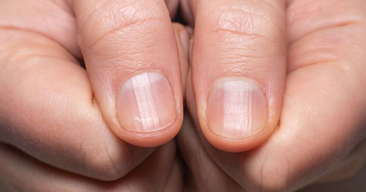 Harvard genetics professor shares what your fingernails say about your 'biological age'