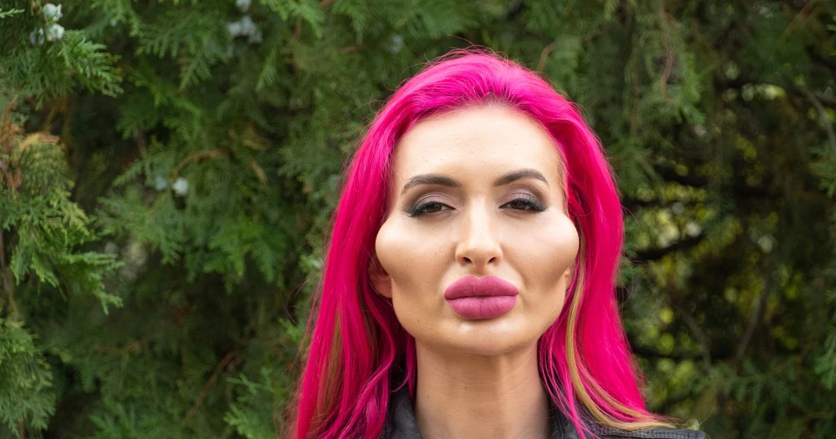 Instagram model with the 'biggest cheeks in the world' claims they are still too small
