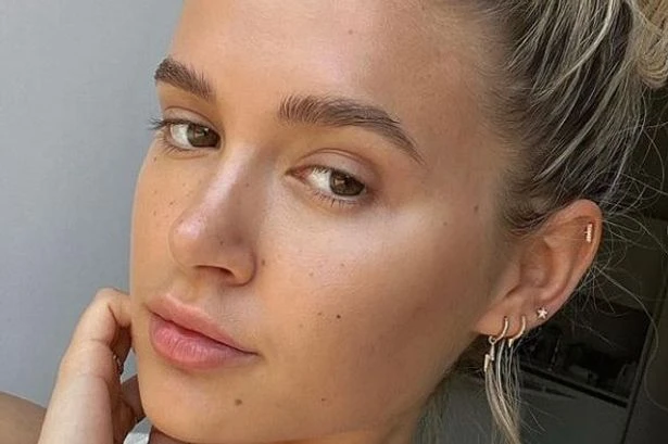 Molly Mae Hague diagnosed with health condition as fans rush to support her