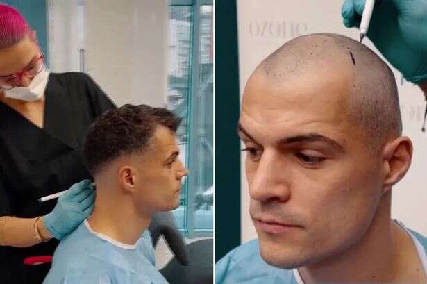 Arsenal cult hero Granit Xhaka shows off astonishing new look as he gets hair transplant