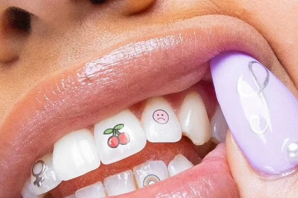 Are Tooth Tattoos the next 2025 trend? New fashion look sees engraved dental caps fitted to teeth for just £200