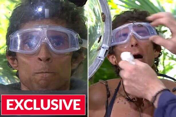 I'm A Celeb star reveals what happened to famous cockroach that got stuck up her nose