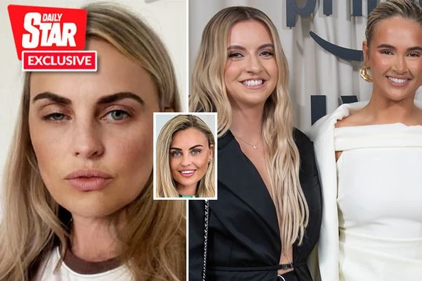 'I got dodgy Botox like Molly-Mae's sister - my face was bodged days before wedding'
