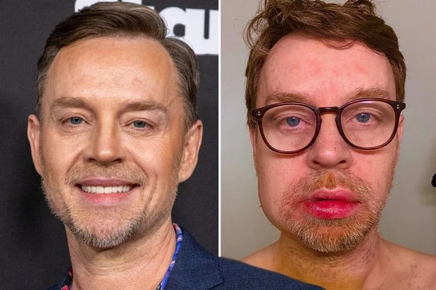 Savage Garden's Darren Hayes almost died after horror accident left him battered