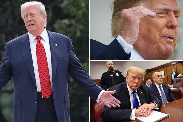 Donald Trump's declining health laid bare as president uses make-up on bruised hand