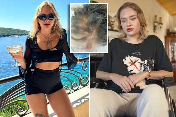 Ukrainian Porta Potty party model admits she was 'scalped by Dubai abusers'