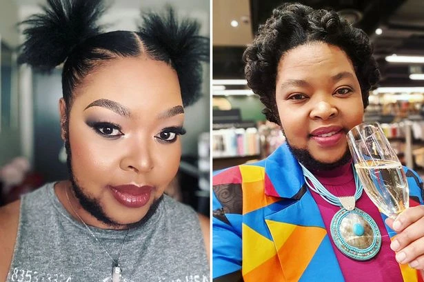 'I'm a bearded woman and dating isn't an issue - men like my fuzzy chin'