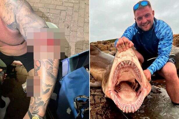 Brit fisherman almost has arm ripped off after being bitten by whopping 300lb shark