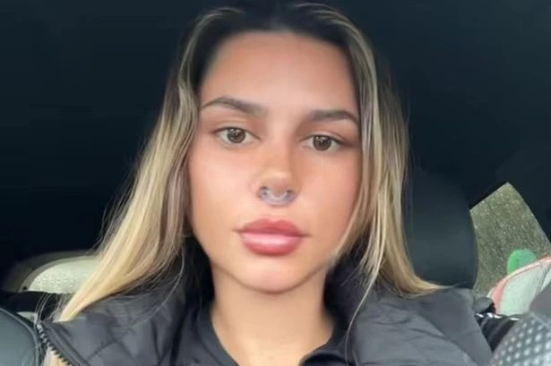 Party girl left with huge hole after nose 'fell out' from ketamine habit