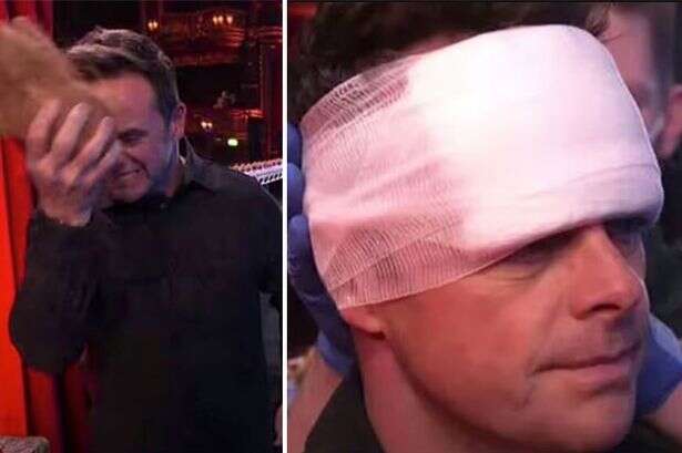 Britain's Got Talent's Ant McPartlin rushed to medics after nasty head injury